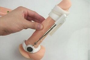 using an extender to enlarge the penis